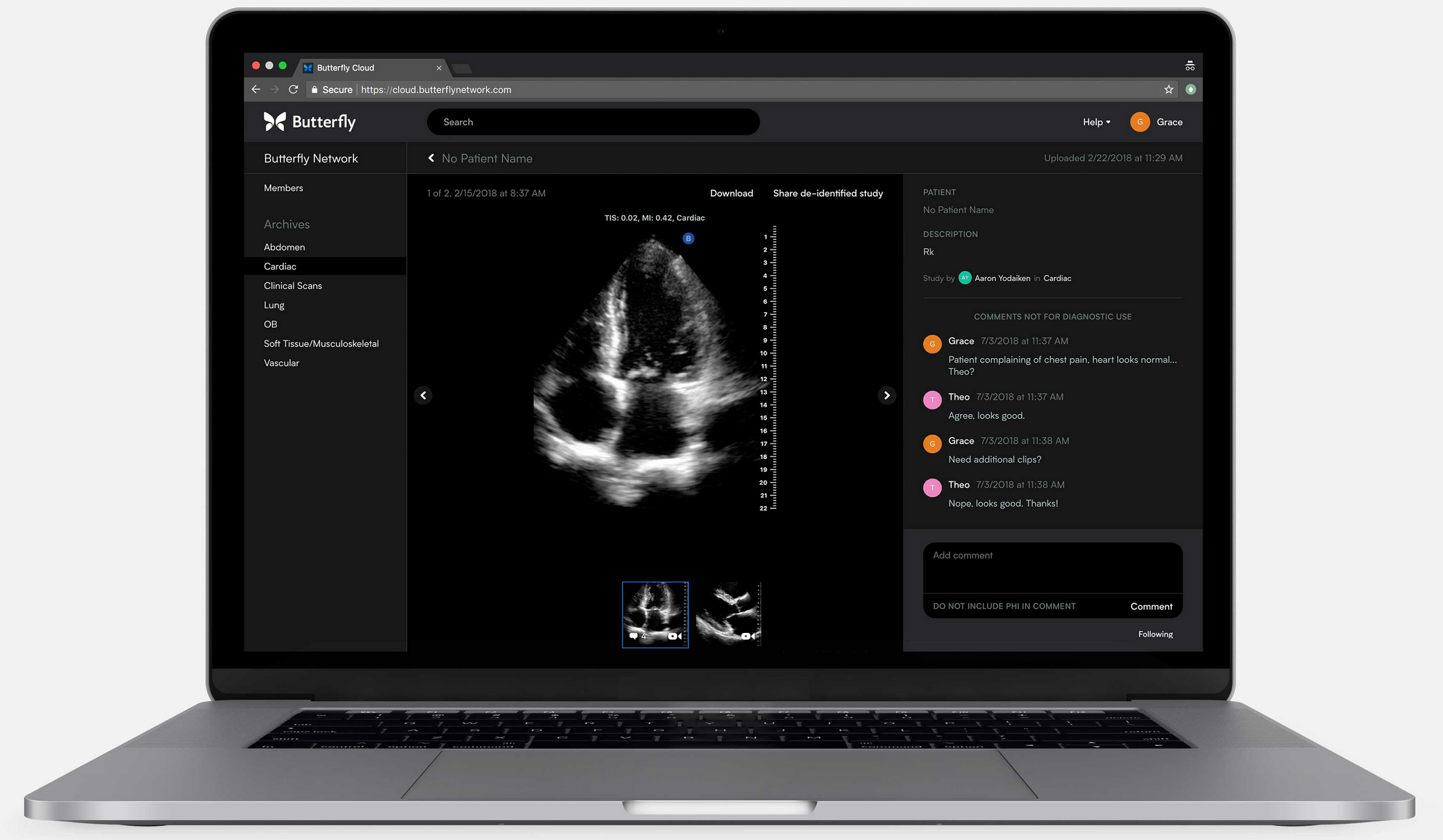 butterfly-network-desktop